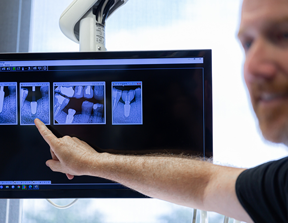 Dentist showing someone x rays of teeth